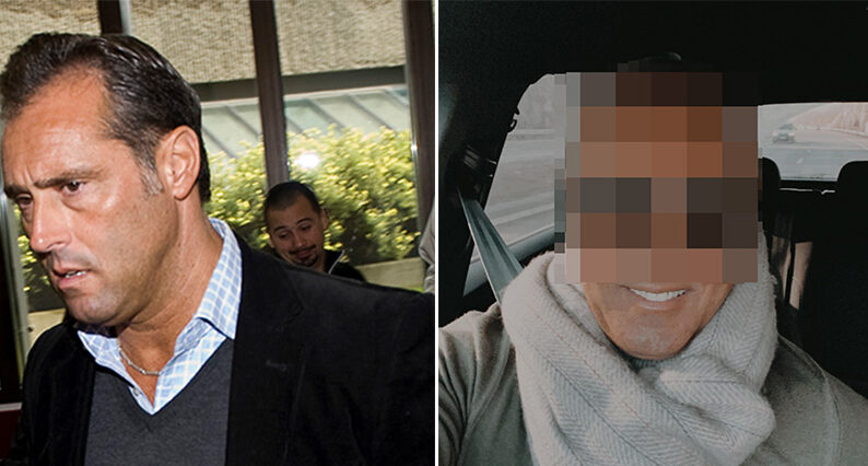 Emilio Ingrossos hemliga skönhetsoperation