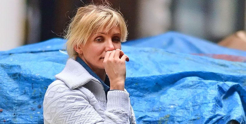 Cameron Diaz hade sv&aring;ra hudproblem i m&aring;nga &aring;r.