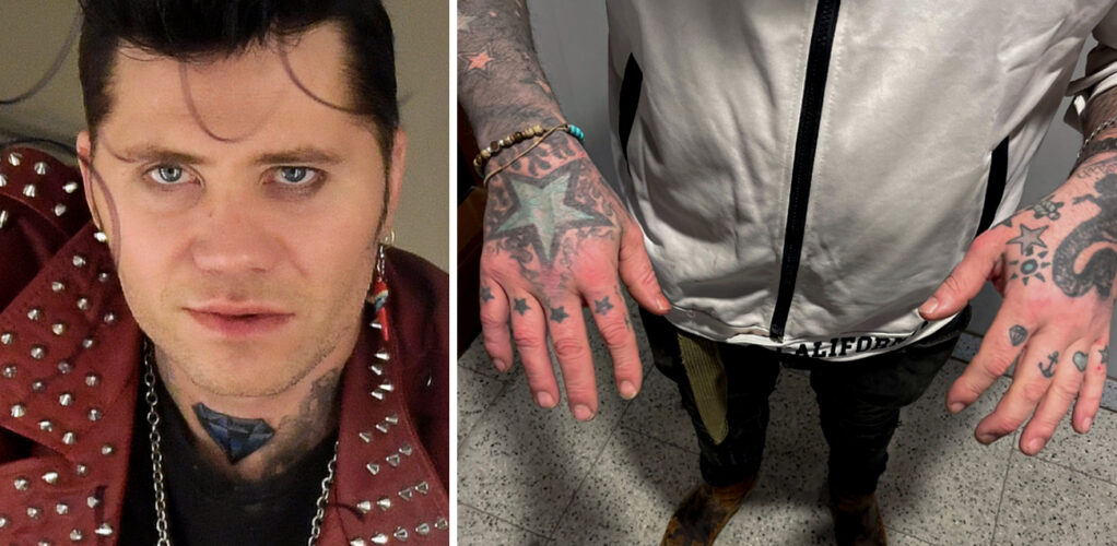Kjell ”Brolle” Wallmark är åtalad för misshandel. Här visar han upp sina händer efter slagsmålet.